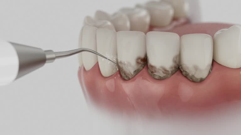 Reliable Wisdom Tooth Removal contractor in Searcy County County, AR by Dentist Open Now